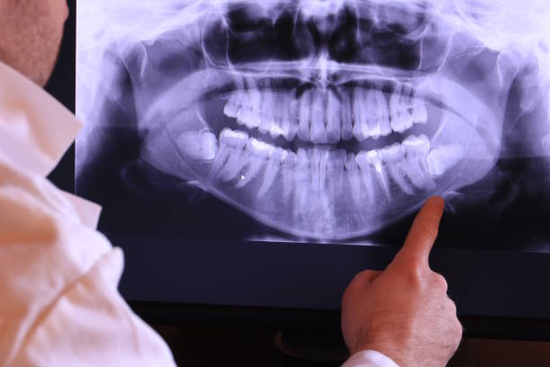 Best Knocked-Out Tooth Emergency  in Jerome, ID